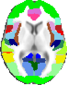 Harvard-Oxford cortical atlas