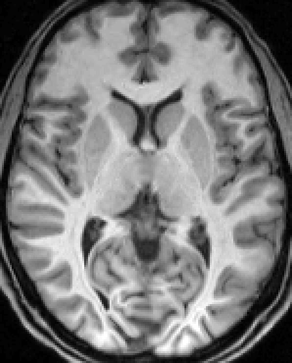 nonlinear registered bias image