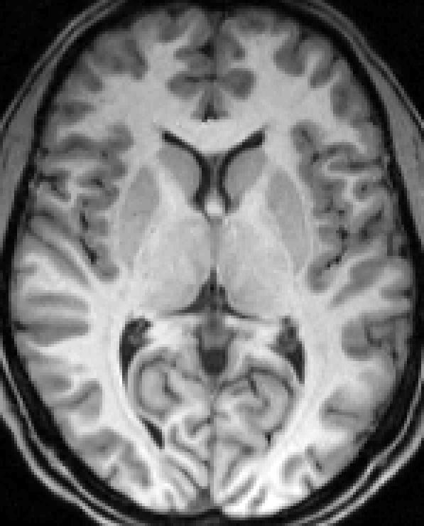 nonlinear registered bias image