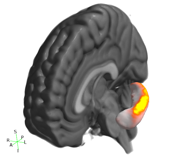 Viewing FIRST results with the FSLeyes 3D view