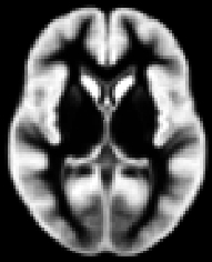 灰质脑模板示例